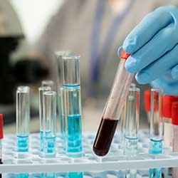 Lab Diagnostic & Instrument Supplies
