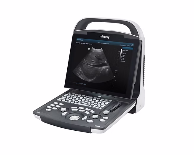 BLACK AND WHITE ULTRASOUND MACHINE WITH CONVEX PROBE - DP-10